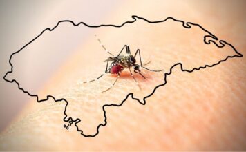 Honduras registra 9,643 casos de dengue y mantiene vigilancia por sarampión y tosferina